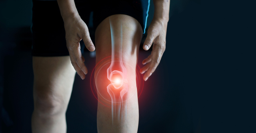 dolore al ginocchio cosa significa davvero quando intervenire e come possono aiutare osteopata e personal trainer